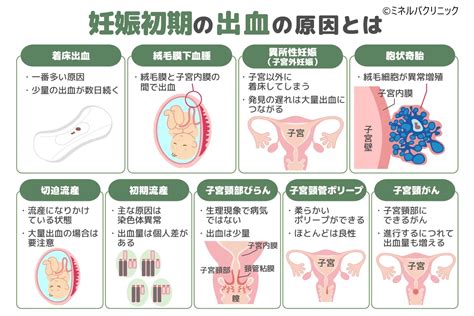 胎盤形成出血|妊娠初期の出血について、原因・対処法を解説！